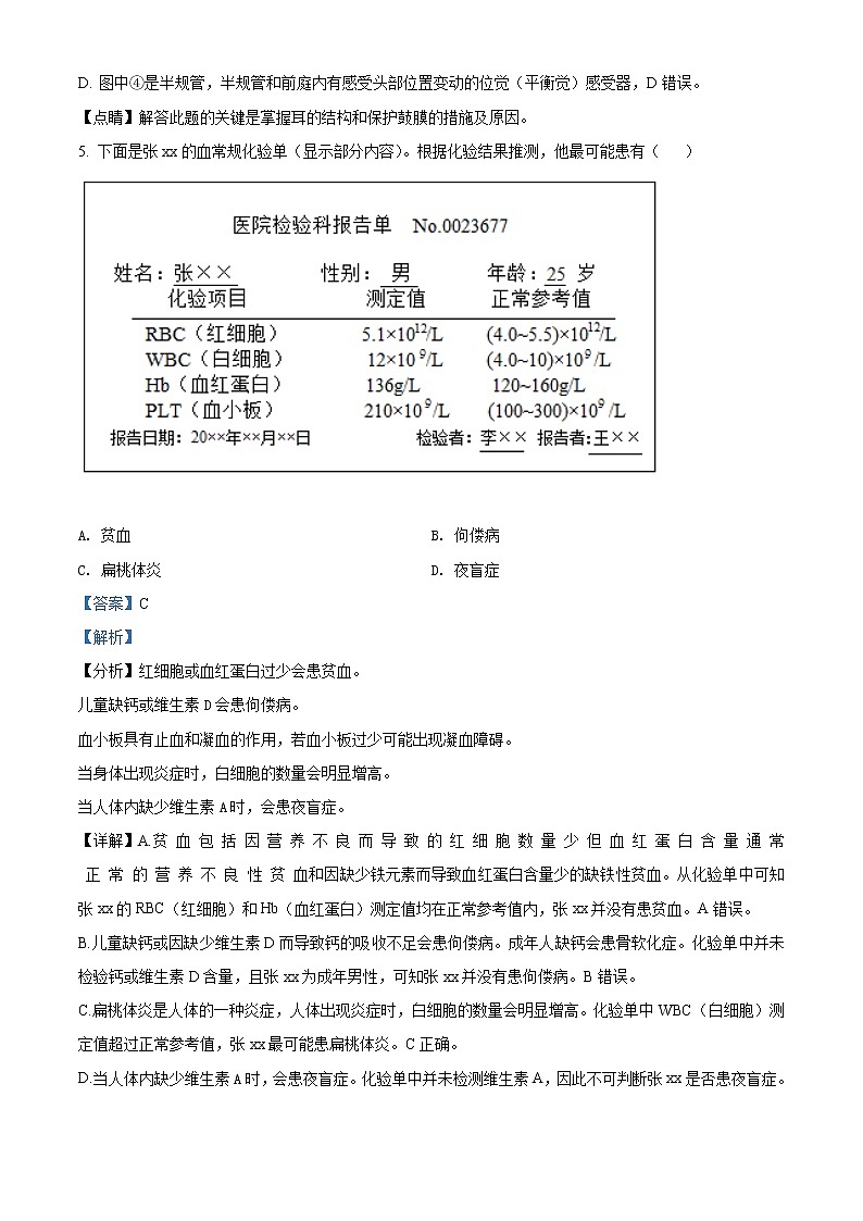 初中生物中考复习 精品解析：2021年河南鲁山县第九初级中学初中学业水平考试模拟生物试题（解析版）第3页