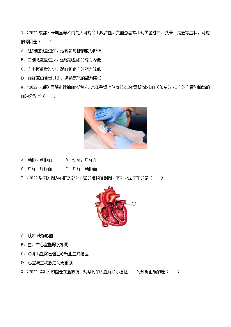 初中生物中考复习 专题06 人体的物质运输和废物排出-三年（2020-2022）中考生物真题分项汇编（全国通用）（原卷版）第2页