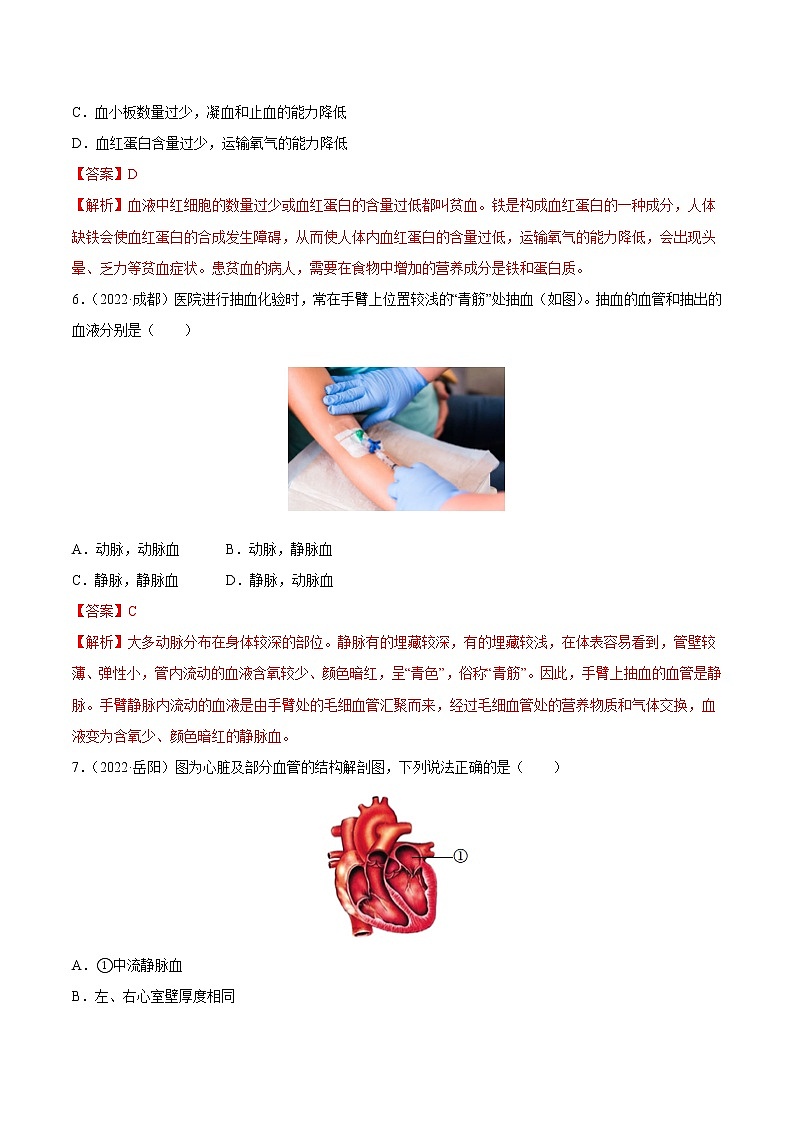 初中生物中考复习 专题06 人体的物质运输和废物排出-三年（2020-2022）中考生物真题分项汇编（全国通用）（解析版）第3页