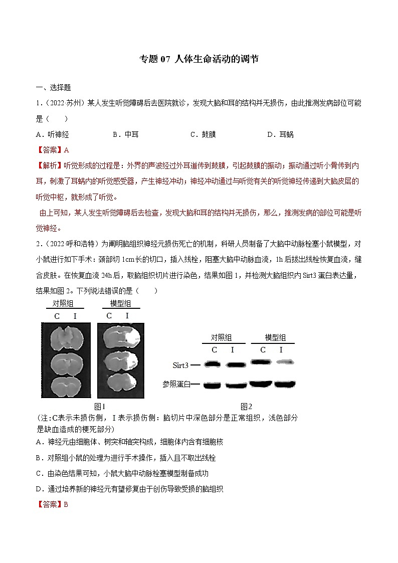 初中生物中考复习 专题07 人体生命活动的调节-三年（2020-2022）中考生物真题分项汇编（全国通用）（解析版）第1页