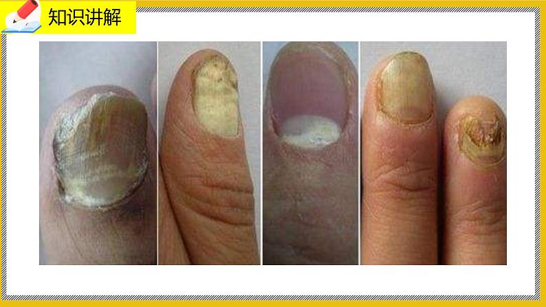 13.2《预防传染病》课件PPT第6页