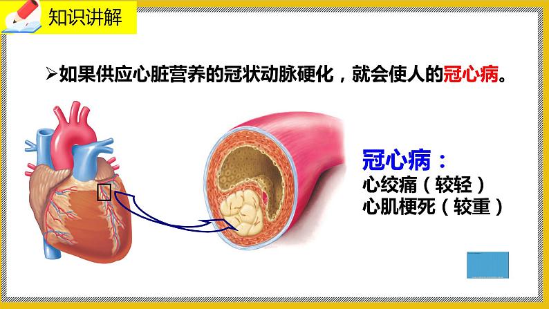 13.4《当代主要疾病和预防》课件PPT+教案+同步练习05