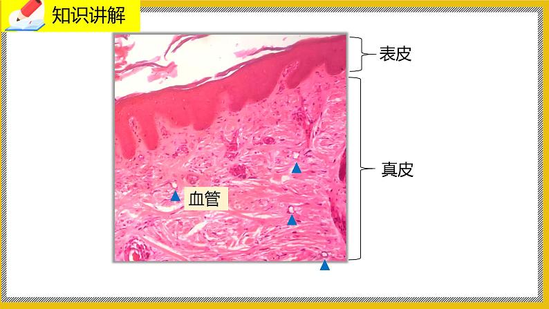 11.3《皮肤与汗腺》课件PPT第6页