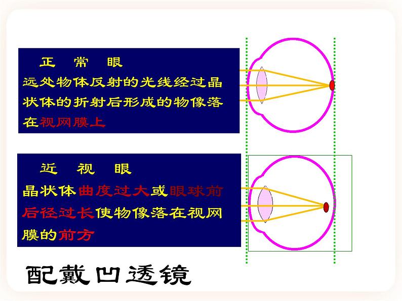 【中考一轮复习】新课标中考生物人教版课件：专题14《人体生命活动的调节》07