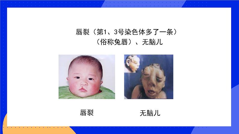 20.6 遗传病和人类健康 课件+练习+素材 北师大版八年级生物上册08