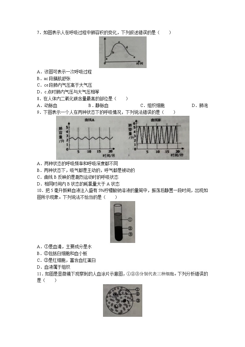 山东省滨州市滨城区2022-2023学年七年级下学期期中生物试题02