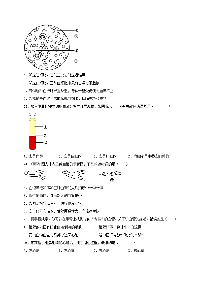 专练02（基础必得选择题70题）——冲刺2023年初中生物人教版会考考前题型专练03