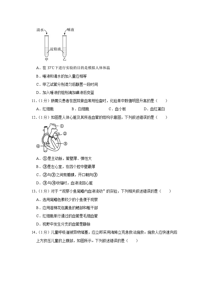 2023年北京市朝阳区中考生物一模试卷（含答案）03