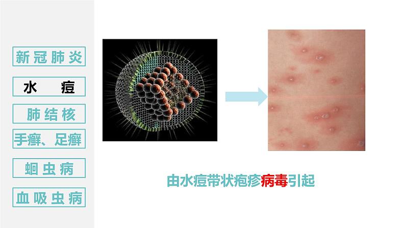 8.1.1传染病及其预防第6页