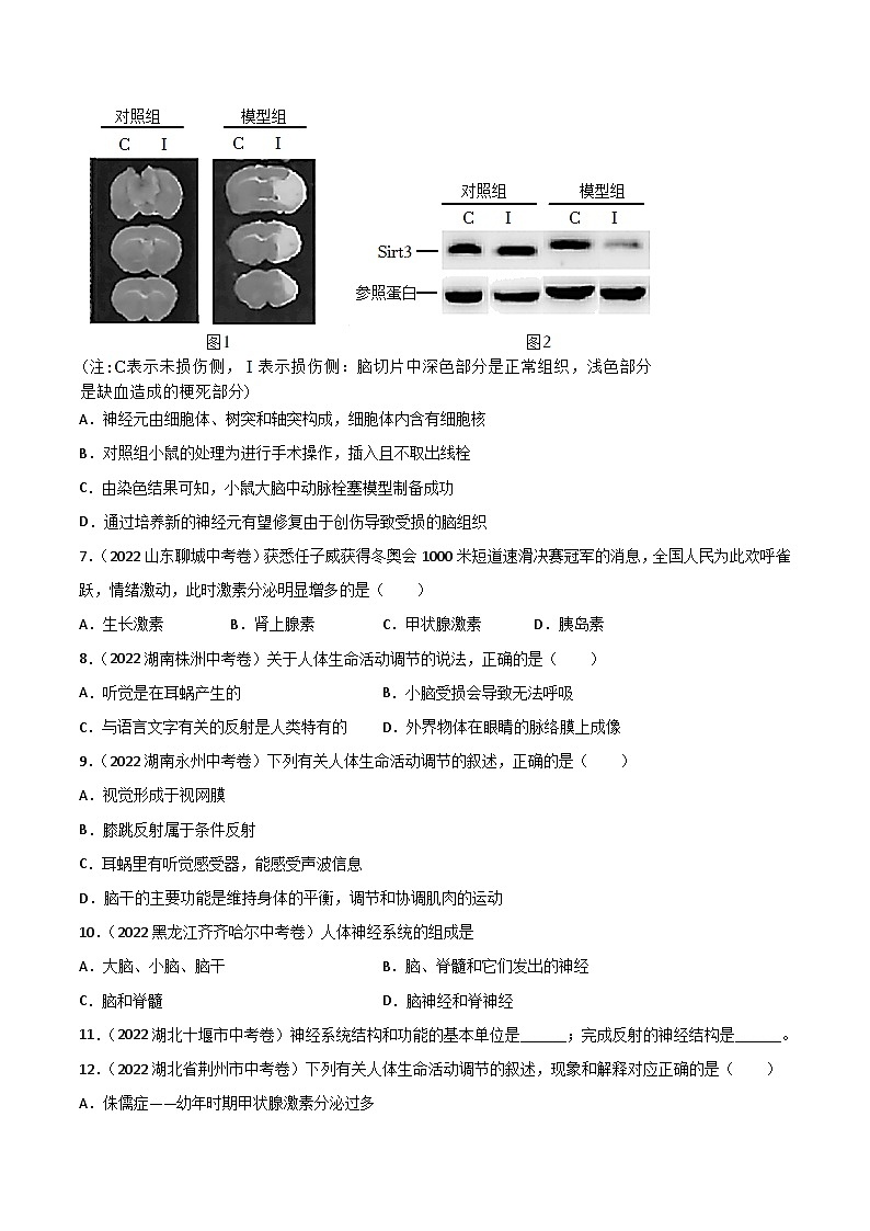 专题07 人体生命活动的调节-中考生物真题分项汇编（全国通用）（第2期）（02