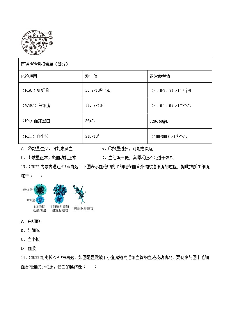 专题06 人体内物质运输和废物排出-中考生物真题分项汇编（全国通用）（第4期）（原卷版）第3页