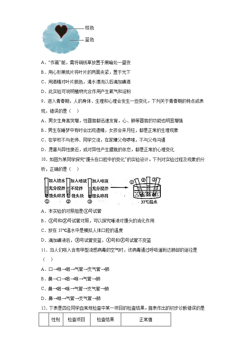 2023年山东省临沂市中考生物真题（含答案）03