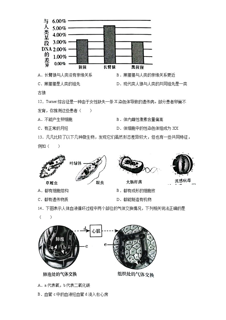 2023年山西省阳泉市中考生物真题（含答案）03