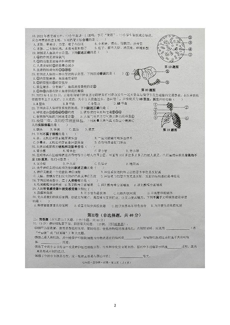 云南省文山州文山市第二学区2022--2023学年七年级下学期期末考试生物试卷02