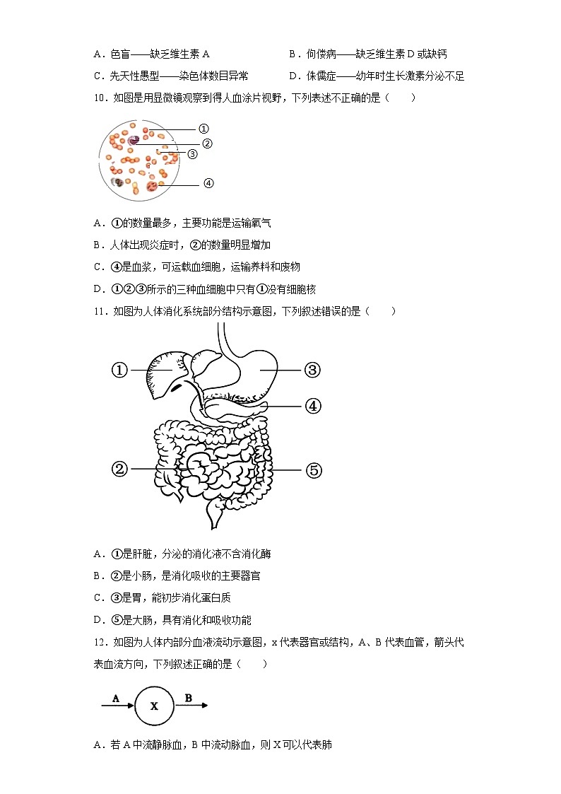 2023年山东省菏泽市鄄城县中考二模生物试题（含解析）03