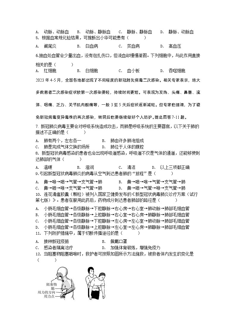 四川省成都市高新区2022-2023学年七年级下学期期末生物试题02