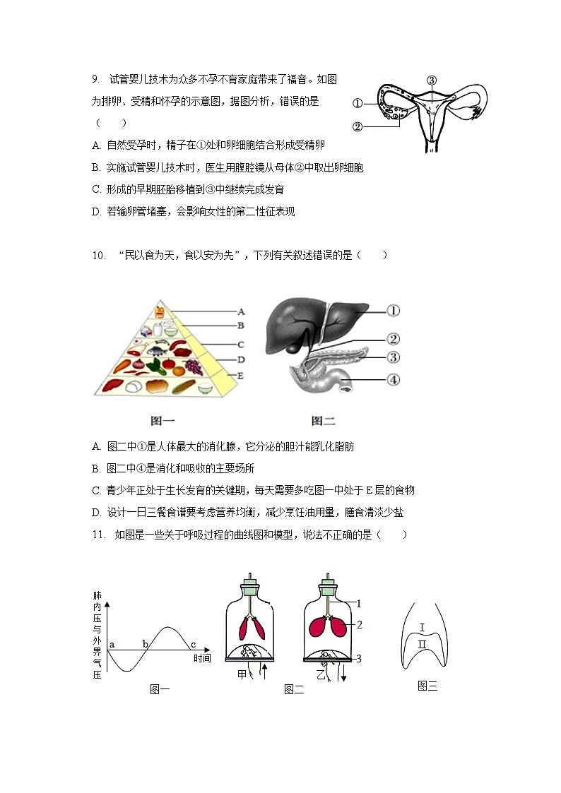 2023年山东省临沂市沂水县中考生物二模试卷（含解析）03