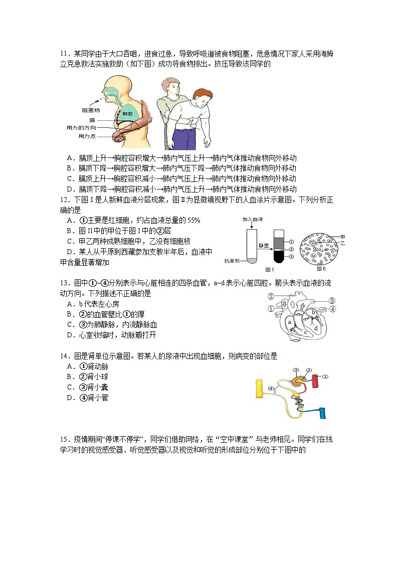 2023年山东省临沂市平邑县初中生物学业水平考试一模生物试题03