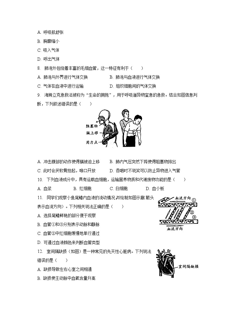 北京市西城区2022-2023学年七年级下学期期末生物试卷（含答案）02