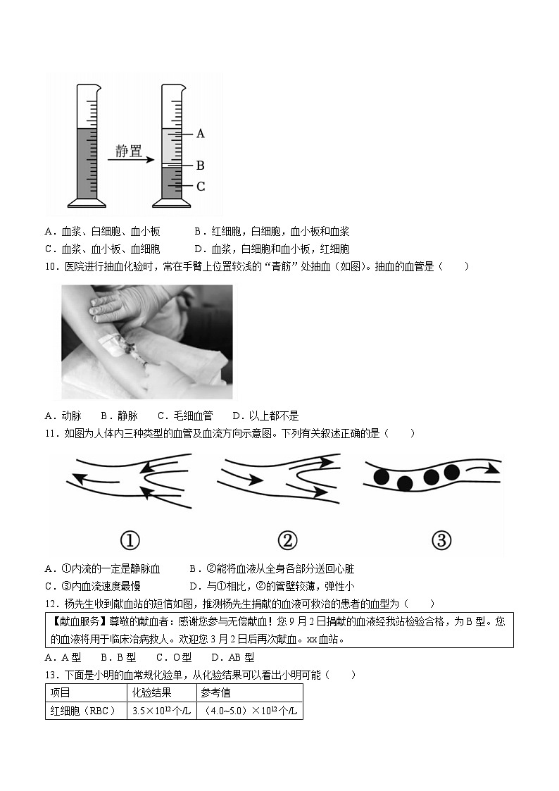河南省洛阳市嵩县2022-2023学年七年级下学期期末生物试题（含答案）03