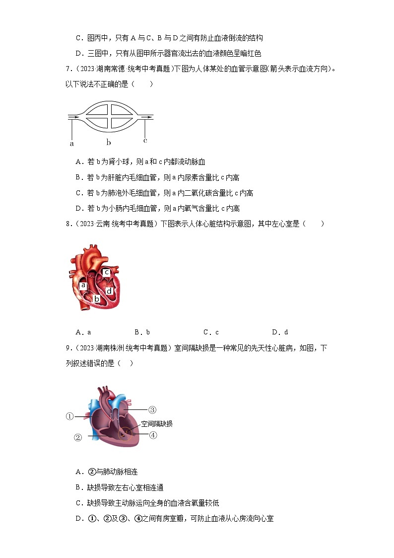 全国中考生物2023年真题分类汇编-31输送血液的泵-心脏选择题03