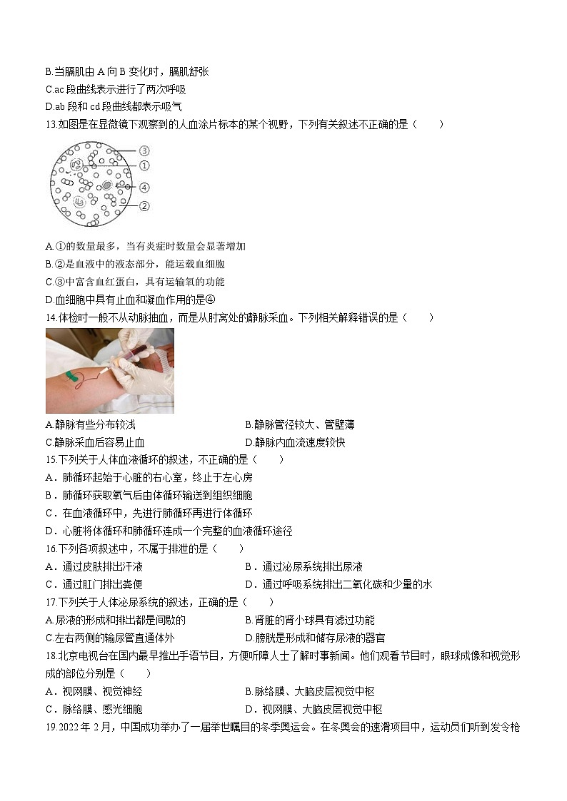河北省承德市丰宁县2022-2023学年七年级下学期期末生物试题03