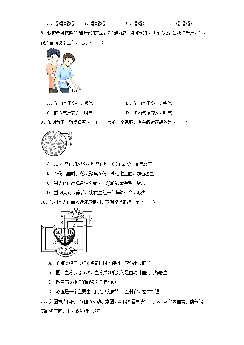 湖南省张家界市永定区2022-2023学年七年级下学期期末生物试题（含答案）第2页