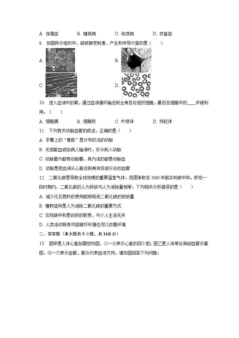 辽宁省大连市西岗区2022-2023学年七年级下学期期末生物试卷（含答案）第2页