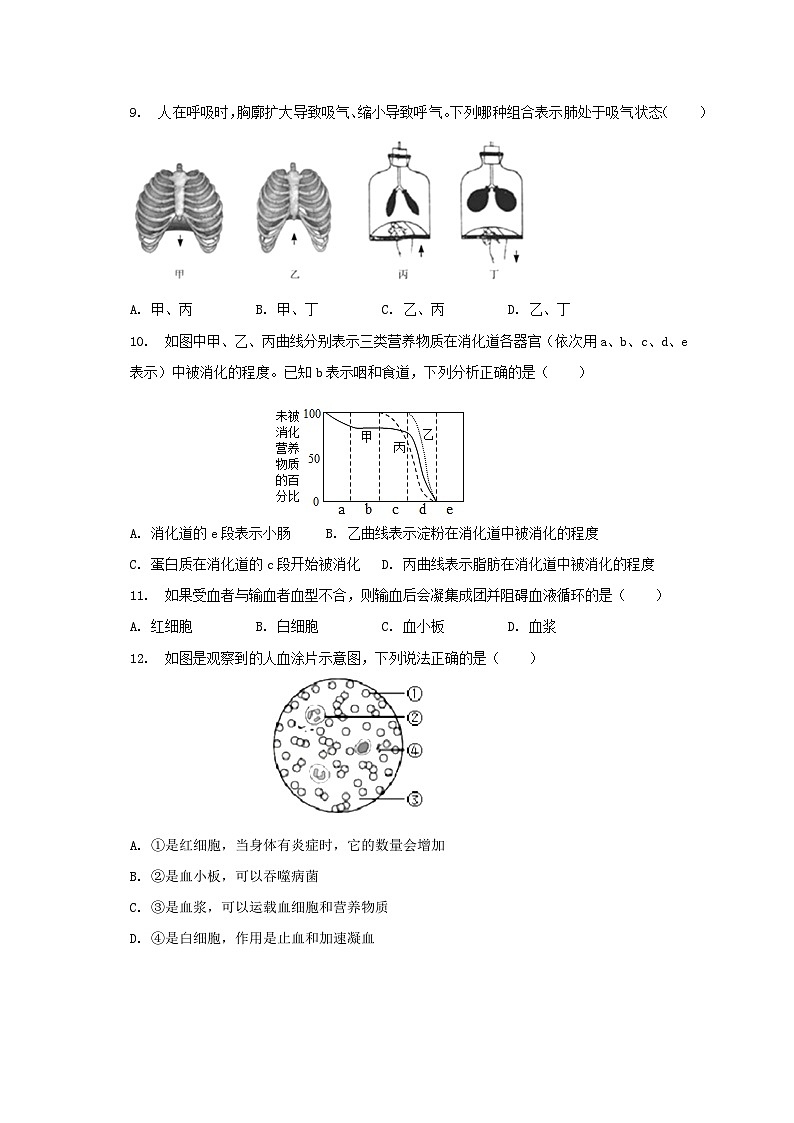 吉林省长春市榆树市慧望初级中学2022-2023学年七年级下学期期末生物试题（含答案）02