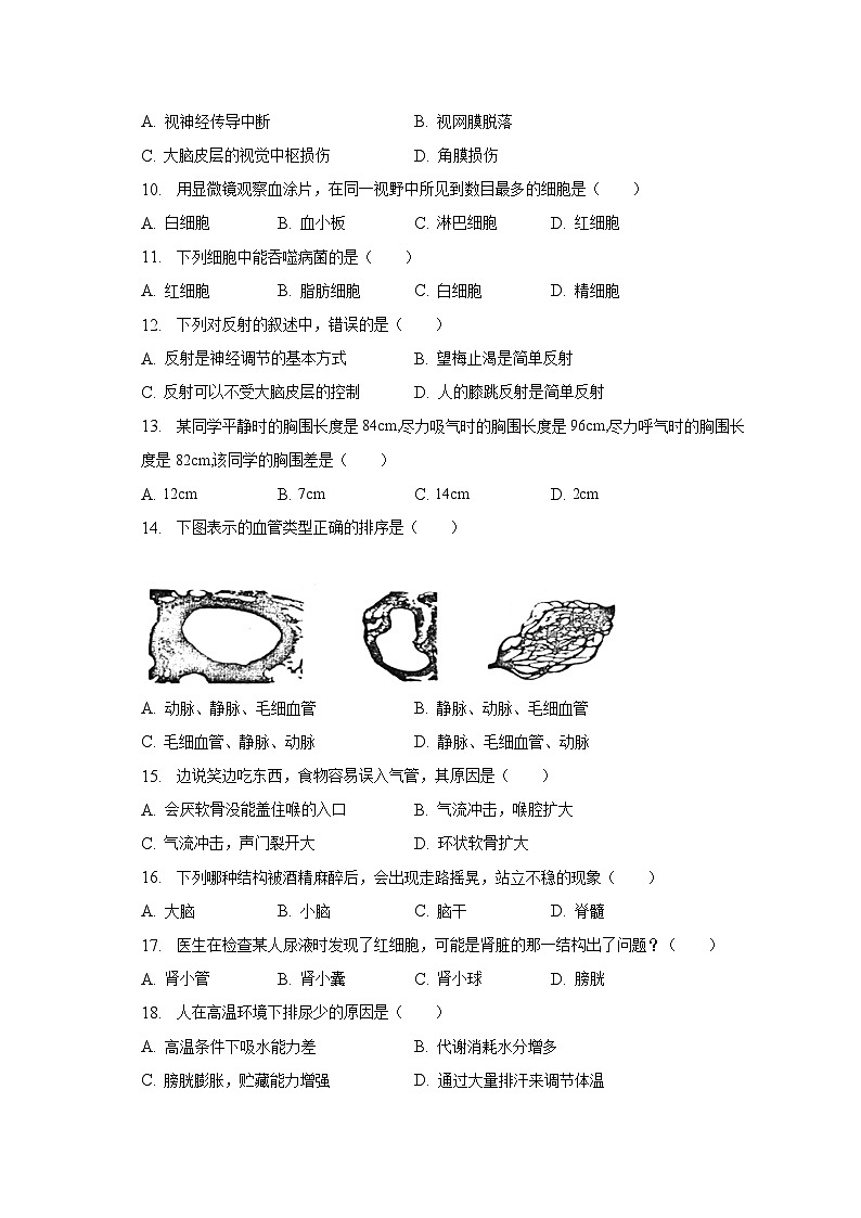 重庆市江北区2022-2023学年七年级下学期期末生物试卷（含答案）02