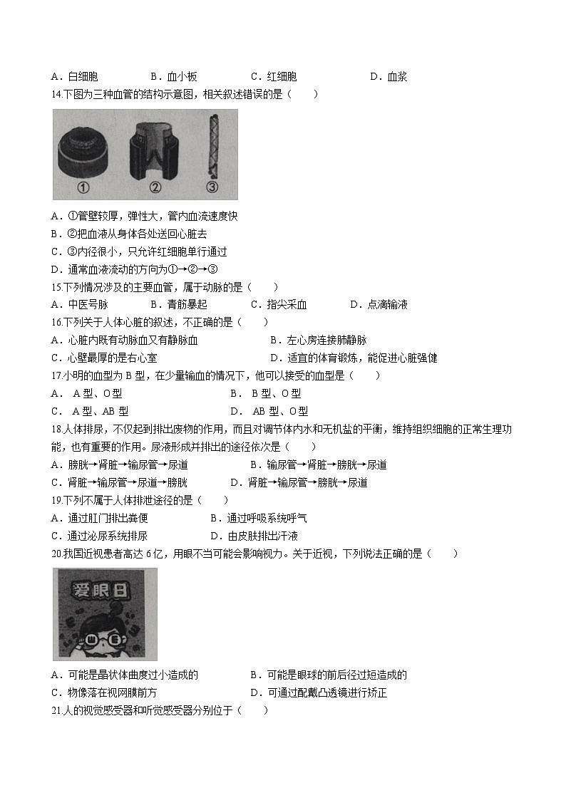云南省部分地州县2022-2023学年七年级下学期期末生物试题（含答案）03
