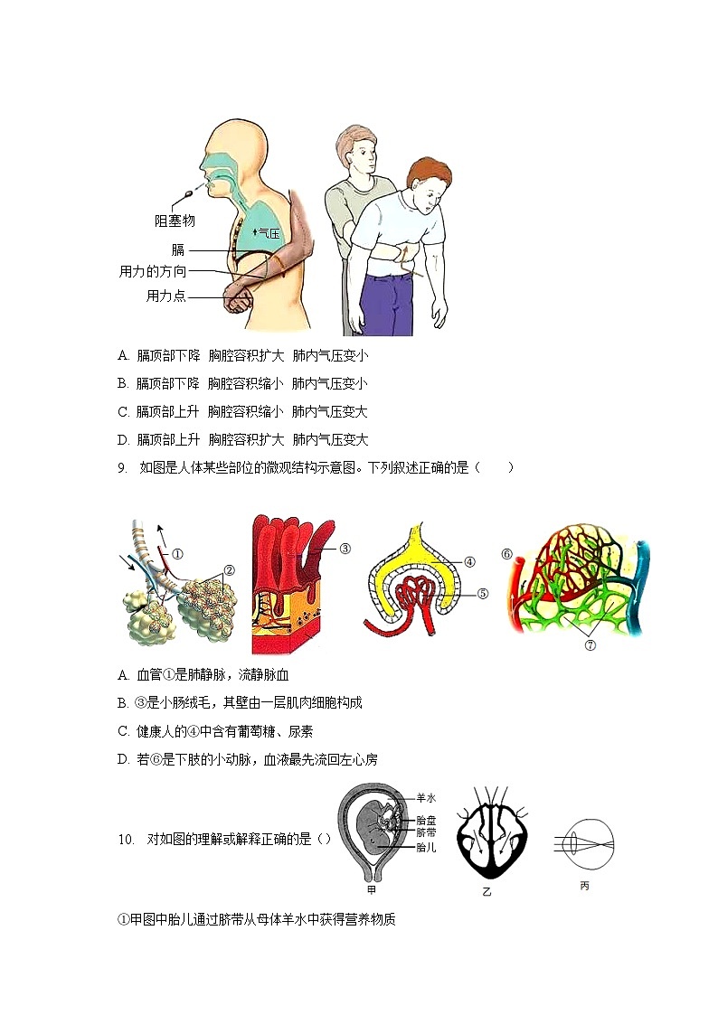 2022-2023学年湖北省孝感市应城市七年级（下）期末生物试卷（含解析）第2页