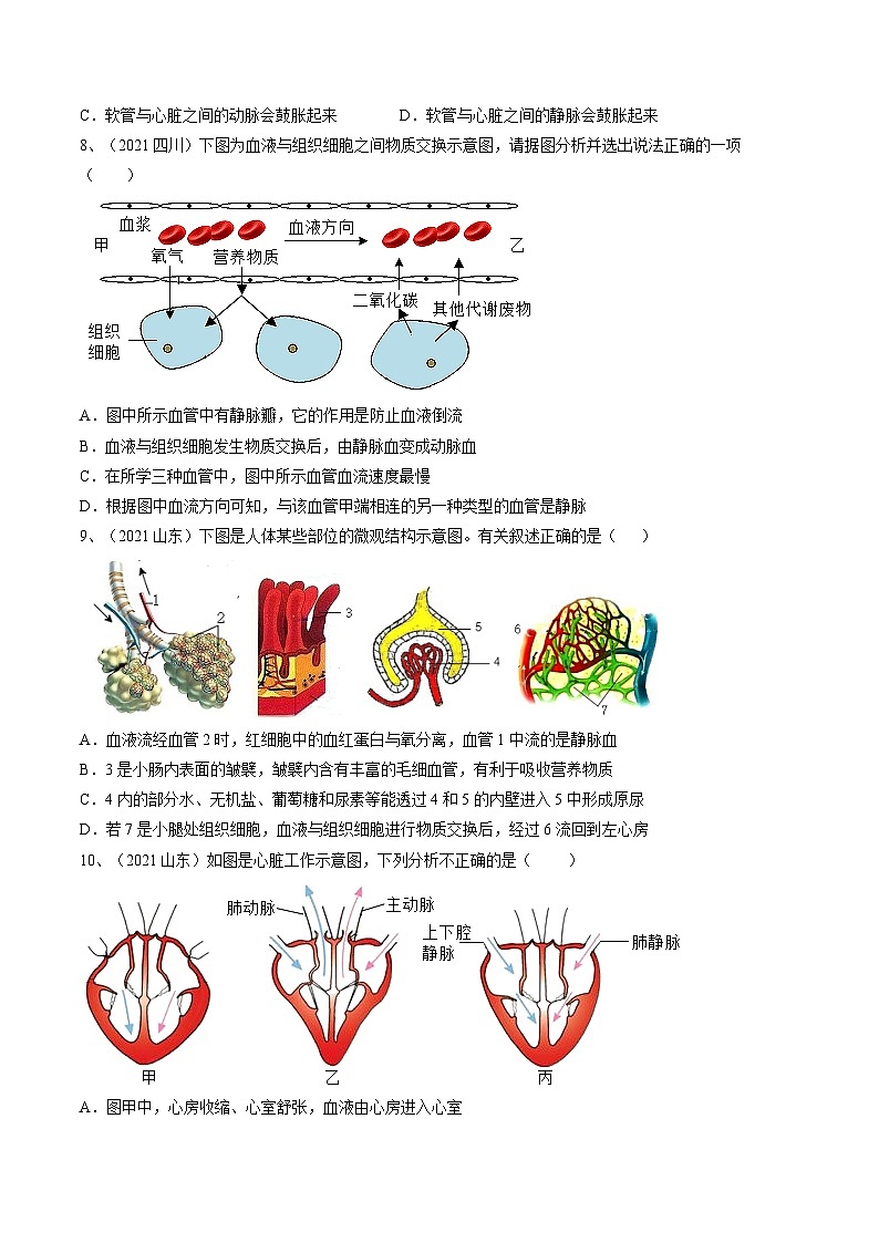 专题12 人体内物质的运输（专题精练）-2023年中考生物一轮复习讲练测（原卷版）03