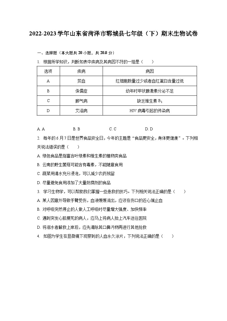 2022-2023学年山东省菏泽市郓城县七年级（下）期末生物试卷（含解析）01