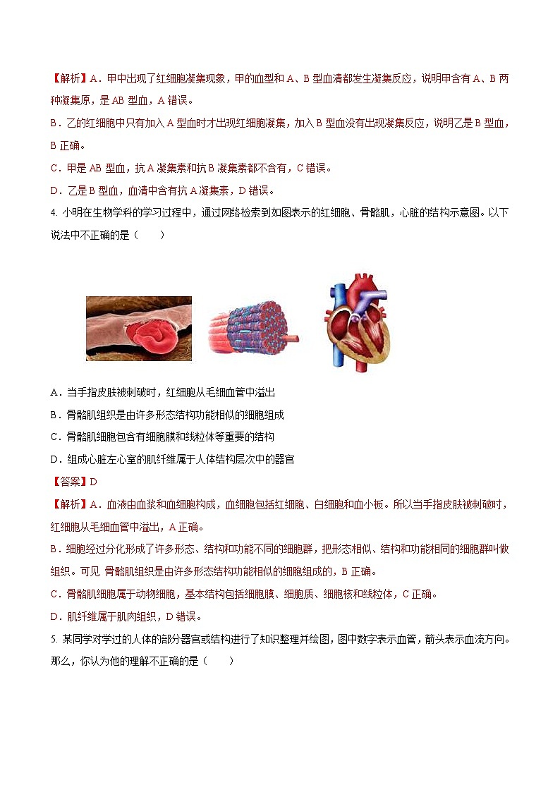 中考生物三轮冲刺压轴题专题06 人体内物质的运输（含解析）03