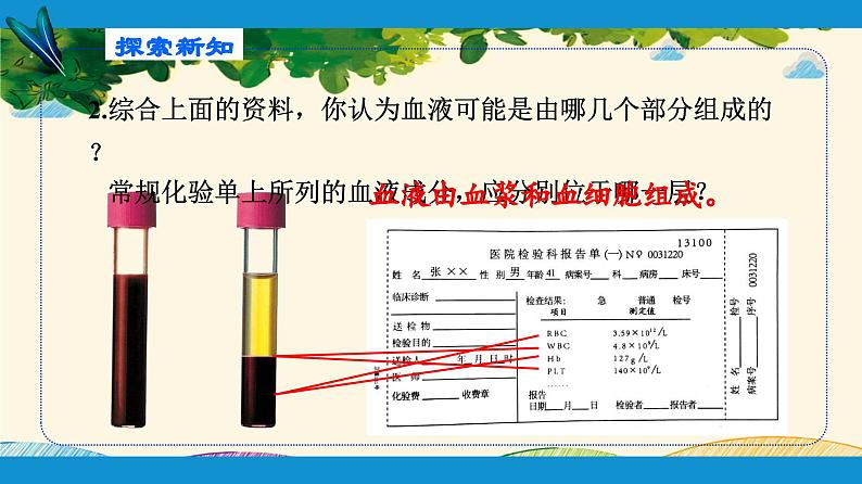 人教版生物七年级下册 第四章  人体内物质 的运输 第一节  流动的组织——血液（案例一）-课件05