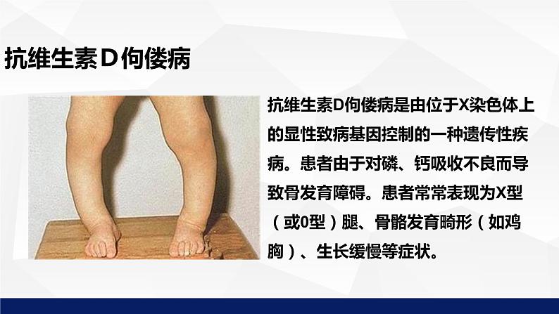 北师大版八年级生物上册 20.6遗传病和人类健康教学课件第7页