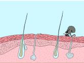 人教版生物八年级下册 第二节 免疫与计划免疫 (2) 课件