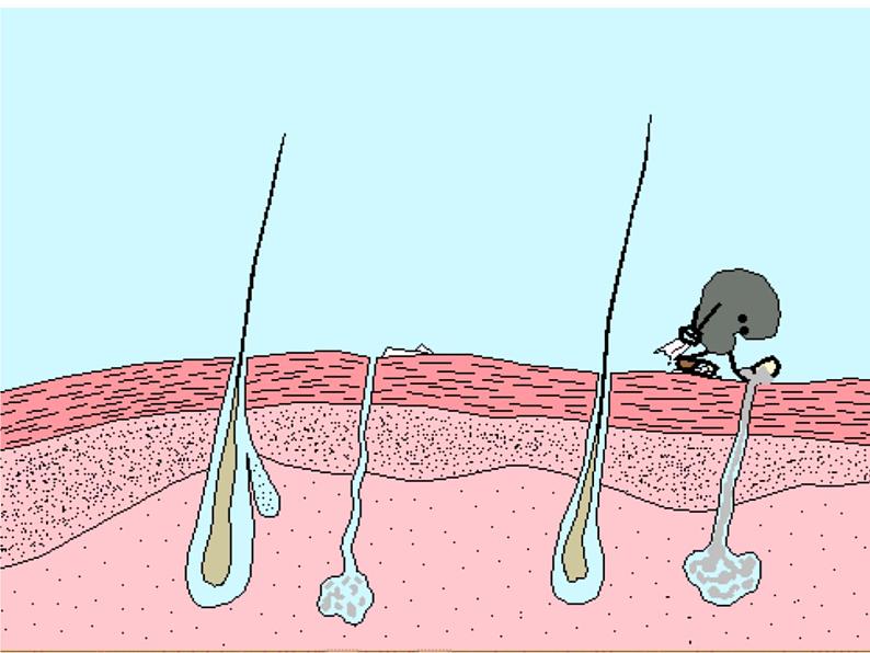 人教版生物八年级下册 第二节 免疫与计划免疫 (2) 课件第4页