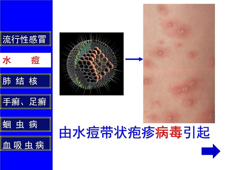 人教版生物八年级下册 第一节 传染病及其预防 (4) 课件第6页