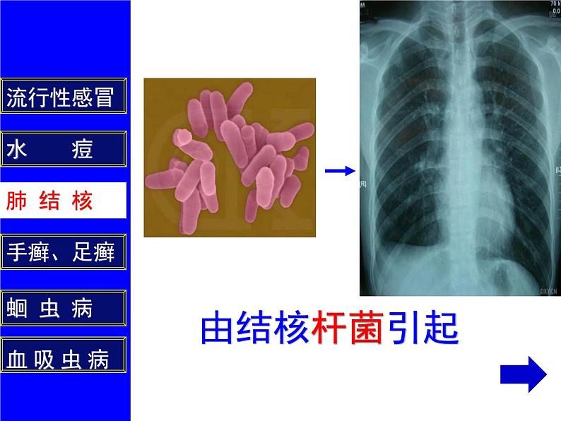 人教版生物八年级下册 第一节 传染病及其预防 (4) 课件第7页