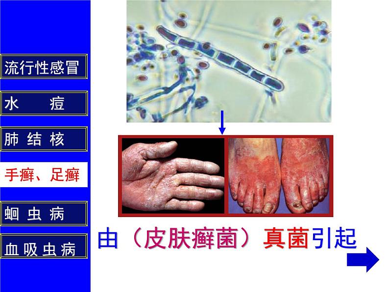 人教版生物八年级下册 第一节 传染病及其预防 (4) 课件第8页