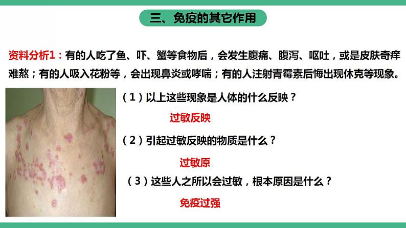 人教版生物八年级下册8.1.2《免疫与计划免疫》（第2课时）课件视频第8页