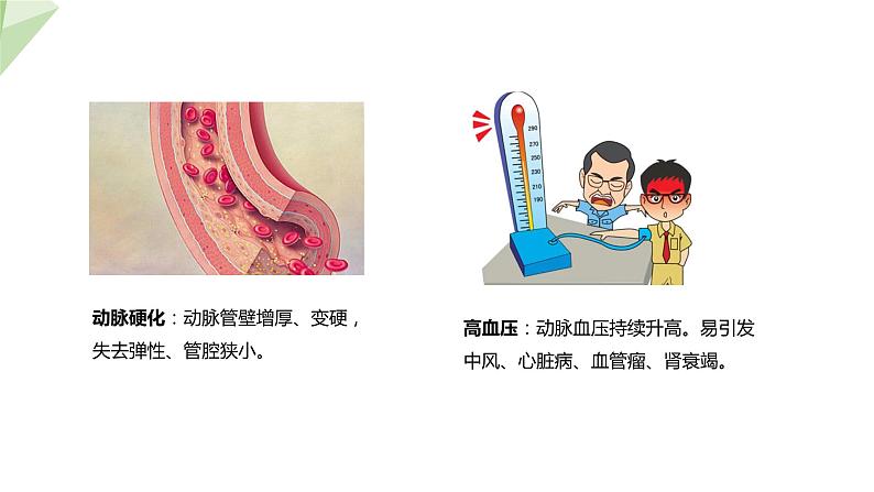 3.3.4 关注心血管健康 课件2023-2024学年初中生物济南版七年级下册07