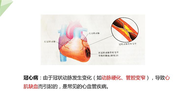 3.3.4 关注心血管健康 课件2023-2024学年初中生物济南版七年级下册08