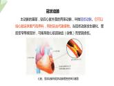 25.2 威胁健康的主要疾病 课件初中生物苏教版八年级下册