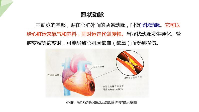 25.2 威胁健康的主要疾病 课件初中生物苏教版八年级下册05