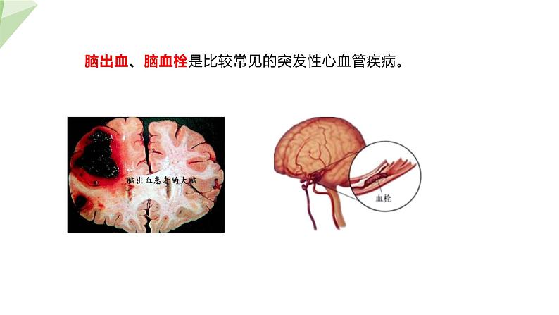 2.2.4 心脏和血管的保护  课件初中生物冀少版七年级下册07