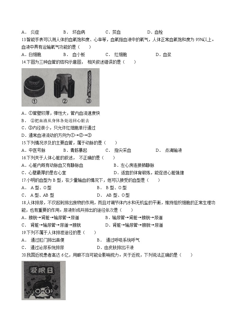 云南省部分地州县2022-2023学年七年级下学期期末生物试题第3页