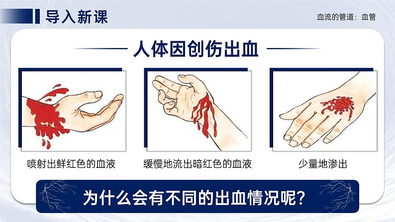 4.4.2《血流的管道—血管》课件03